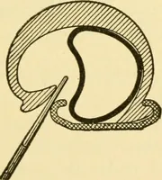 An illustration from Audels answers on automobiles, for owners, operators, repairmen ... including chapters on the storage battery, electric vehicles, motor cycles, overhauling the car, etc. Fully illustrated and indexed (1911)
