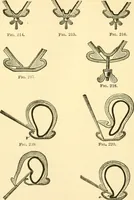 An illustration from Audels answers on automobiles, for owners, operators, repairmen ... including chapters on the storage battery, electric vehicles, motor cycles, overhauling the car, etc. Fully illustrated and indexed (1911)