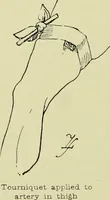 Picture 48 of 68 from Famous airmen and their equipment [electronic resource] : with some notes on first-aid in emergencies (1912), leaf 69
