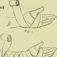 An illustration from Famous airmen and their equipment [electronic resource] : with some notes on first-aid in emergencies (1912)