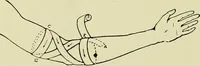An illustration from Famous airmen and their equipment [electronic resource] : with some notes on first-aid in emergencies (1912)