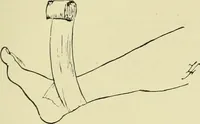 An illustration from Famous airmen and their equipment [electronic resource] : with some notes on first-aid in emergencies (1912)