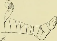 An illustration from Famous airmen and their equipment [electronic resource] : with some notes on first-aid in emergencies (1912)