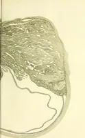 An illustration from Das Sarkom des Auges [electronic resource] (1900)