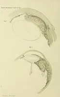 Picture 4 of 6 from Das Sarkom des Auges [electronic resource] (1900), leaf 324