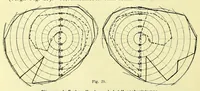 An illustration from Die StÃ¶rungen des Farbensinnes [electronic resource] : ihre klinische Bedeutung und ihre Diagnose (1912)