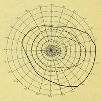 An illustration from Remarks on the field of vision in certain cases of "neglected eyes" / by G. E. de Schweinitz. (1895)