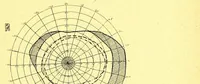 An illustration from Remarks on the field of vision in certain cases of "neglected eyes" / by G. E. de Schweinitz. (1895)