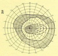 An illustration from Remarks on the field of vision in certain cases of "neglected eyes" / by G. E. de Schweinitz. (1895)