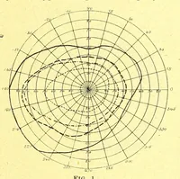 An illustration from Remarks on the field of vision in certain cases of "neglected eyes" / by G. E. de Schweinitz. (1895)