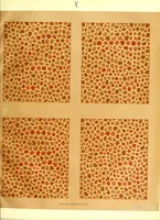 Picture 7 of 8 from Pseudo-isochromatische Tafeln für die Prüfung des Farbensinnes (1883), leaf 19