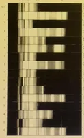 An illustration from Notes on the chromatology of Anthea cereus (1887)