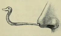 Picture 13 of 17 from Vergleichende Volksmedizin : eine Darstellung volksmedizinischer Sitten und Gebräuche, Anschauungen und Heilfaktoren, des Aberglaubens und der Zaubermedizin (1908), leaf 376