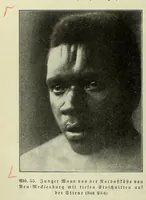 An illustration from Vergleichende Volksmedizin : eine Darstellung volksmedizinischer Sitten und Gebräuche, Anschauungen und Heilfaktoren, des Aberglaubens und der Zaubermedizin (1908)
