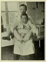 An illustration from Vergleichende Volksmedizin : eine Darstellung volksmedizinischer Sitten und Gebräuche, Anschauungen und Heilfaktoren, des Aberglaubens und der Zaubermedizin (1908)