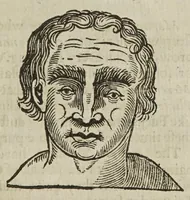 An illustration from Anthropometamorphosis: man transform'd; or, the artificial changeling. Historically presented, in the mad and cruel gallantry, foolish bravery, ridiculous beauty, filthy finenesse, and loathsome lovelinesse of most nations, fashioning and altering their bodies from the mould intended by nature. With a vindication of the regular beauty and honesty of nature. And an appendix of the pedigree of the English gallant (1653)