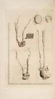 Picture 11 of 21 from The anatomy of humane bodies, with figures drawn after the life ... by some of the best masters in Europe ... and curiously engraven in one hundred and fourteen copper plates, illustrated with large explications, containing many new anatomical discoveries, and chirurgical observations. To which is added an introduction explaining the animal oeconomy. With a copious index (1698), leaf 171
