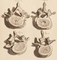 An illustration from The anatomy of humane bodies, with figures drawn after the life ... by some of the best masters in Europe ... and curiously engraven in one hundred and fourteen copper plates, illustrated with large explications, containing many new anatomical discoveries, and chirurgical observations. To which is added an introduction explaining the animal oeconomy. With a copious index (1698)