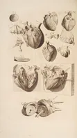 An illustration from The anatomy of humane bodies, with figures drawn after the life ... by some of the best masters in Europe ... and curiously engraven in one hundred and fourteen copper plates, illustrated with large explications, containing many new anatomical discoveries, and chirurgical observations. To which is added an introduction explaining the animal oeconomy. With a copious index (1698)