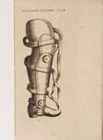 An illustration from Gallicinium medico-practicum. Sive consiliorum, observationum et curationum medicinalium novarum centuriae duae, cum dimidia ... (1700)