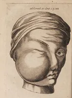 Picture 8 of 15 from Gallicinium medico-practicum. Sive consiliorum, observationum et curationum medicinalium novarum centuriae duae, cum dimidia ... (1700), leaf 222