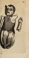Picture 1 of 3 from Collectanea de diuturna graviditate (1662), leaf 53