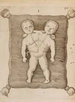 An illustration from Generosissimi, nobilissimi, expertissimique Di. Di. Ludovici de Bils à Copensdamme, Bonem, &c. Di. Urbis atque territorii Arbenburgici praetoris Specimina anatomica : cum clariss. doctissimorumque virorum epistolis aliquot & testimoniis. (1661)
