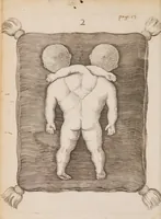 Picture 4 of 5 from Generosissimi, nobilissimi, expertissimique Di. Di. Ludovici de Bils à Copensdamme, Bonem, &c. Di. Urbis atque territorii Arbenburgici praetoris Specimina anatomica : cum clariss. doctissimorumque virorum epistolis aliquot & testimoniis. (1661), leaf 18