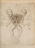 An illustration from Generosissimi, nobilissimi, expertissimique Di. Di. Ludovici de Bils à Copensdamme, Bonem, &c. Di. Urbis atque territorii Arbenburgici praetoris Specimina anatomica : cum clariss. doctissimorumque virorum epistolis aliquot & testimoniis. (1661)