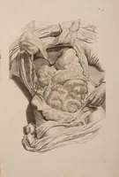 Picture 3 of 9 from Ontleding des menschelyken lichaams ... (1690), leaf 128