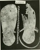 Picture 16 of 55 from Balabish (1920), leaf 102