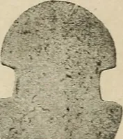 An illustration from Bernstein (1920)