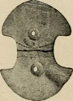 An illustration from Bernstein (1920)