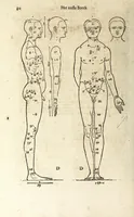 An illustration from Beschryvinghe van Albrecht Durer van de menschelijcke proportion : begrepen in vier onderscheyden boecken, zeer nut ende profijtelijck voor alle lief-hebbers defer konste : in't latijn ende hooghduytsch, tot Nurenbergh ghedruct, tot koste van syne nae-ghelaten weduvve, in't iaer ons Heeren 1527 : ende nu in onse Nederlandtsche sprake over-gheset, tot dienste der ghener die de konste beminnen, ende de latijnsche ofte hooghduytsche sprake niet en cerstaen (1622)