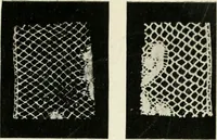 Picture 3 of 77 from Bobbins of Belgium; a book of Belgian lace, lace-workers, lace-schools and lace-villages (1920), leaf 10