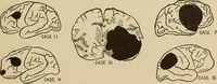Picture 52 of 52 from Brain in relation to mind (1899), leaf 146