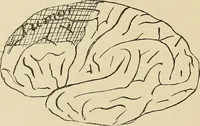 Picture 13 of 52 from Brain in relation to mind (1899), leaf 51