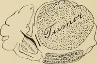 Picture 18 of 52 from Brain in relation to mind (1899), leaf 65