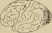 An illustration from Brain in relation to mind (1899)