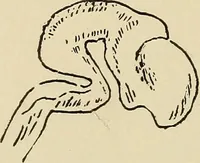 An illustration from Brain in relation to mind (1899)