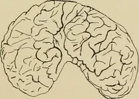 An illustration from Brain in relation to mind (1899)