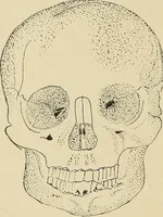 An illustration from Brain in relation to mind (1899)