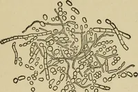 An illustration from Breeding, training, management and diseases of the horse and other domestic animals (1893)