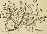 An illustration from Breeding, training, management and diseases of the horse and other domestic animals (1893)