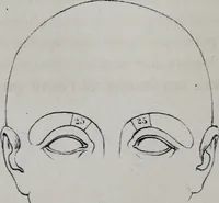 An illustration from Caractères phrénologiques et physiognomoniques des contemporains les plus célèbres, selon les systèmes de Gall, Spurzheim, Lavater, etc. (1837)