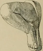 An illustration from Catalogue of plaster reproductions from antique, medieval and modern sculpture : subjects suitable for schools, libraries, and homes. (1911)