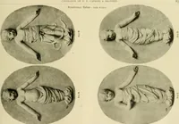An illustration from Catalogue of plaster cast reproductions from antique, medieval and modern sculpture. (1894)