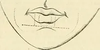 An illustration from Celse, Vitruve, Censorin (oeuvres complètes), Frontin (Des aqueducs de Rome) ; avec la traduction en français [et] publiés sous la direction de M. Nisard (1866)