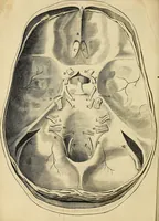 An illustration from Cerebri anatome : cui accessit nervorum descriptio et usus (1664)