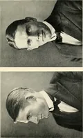 An illustration from Character revelations of mind and body; a statement of methods for the study of the indications of character which are built into the face as a result of mental and bodily reactions (1922)